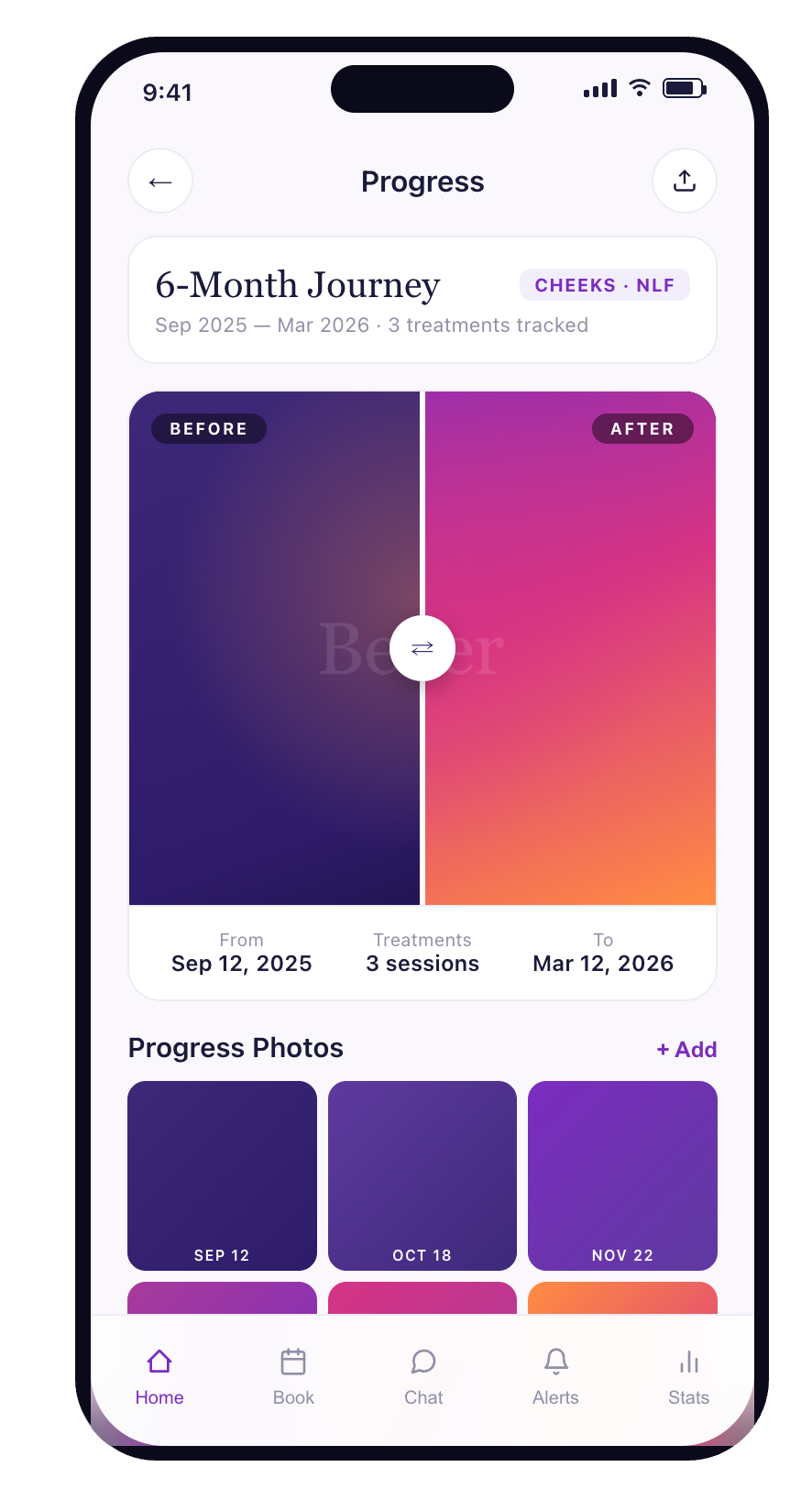 Rinnova progress tracking screen